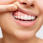 7 Cara Alami Menjaga Kesehatan Gusi