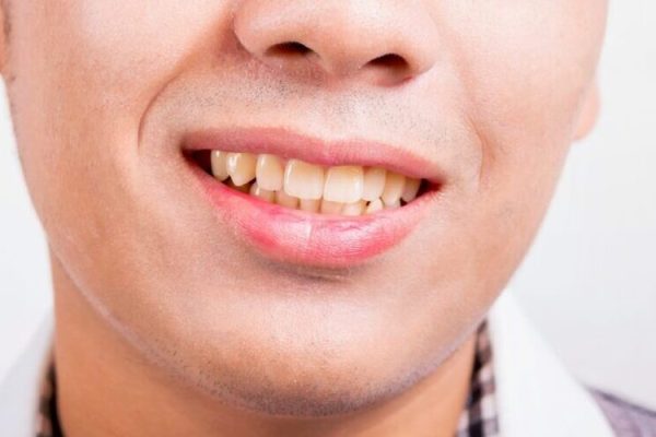 10 Cara Menjaga Kesehatan Rahang Sejak Dini