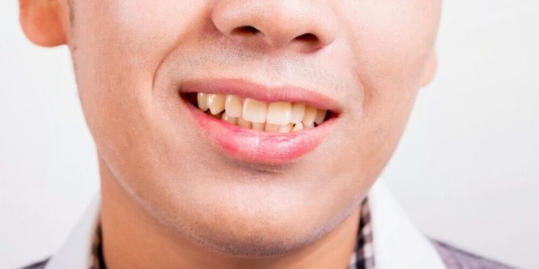 10 Cara Menjaga Kesehatan Rahang Sejak Dini