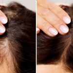 7 Tips Mengatasi Rambut Rontok Tanpa Obat Kimia