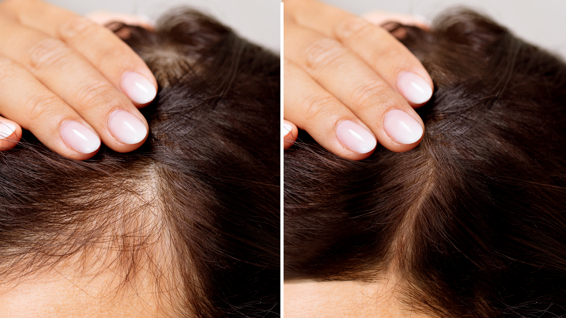 7 Tips Mengatasi Rambut Rontok Tanpa Obat Kimia