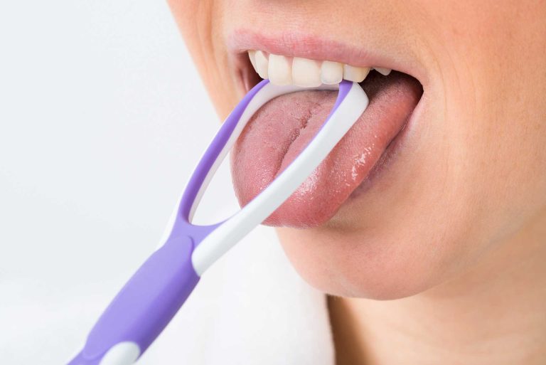 7 Cara Merawat Lidah agar Tetap Bersih, Sehat, dan Bebas Bau Mulut